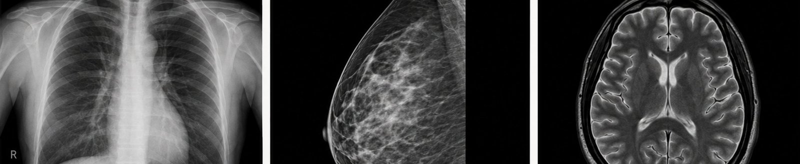 Example medical images: chest X-ray, mammogram and brain MRI